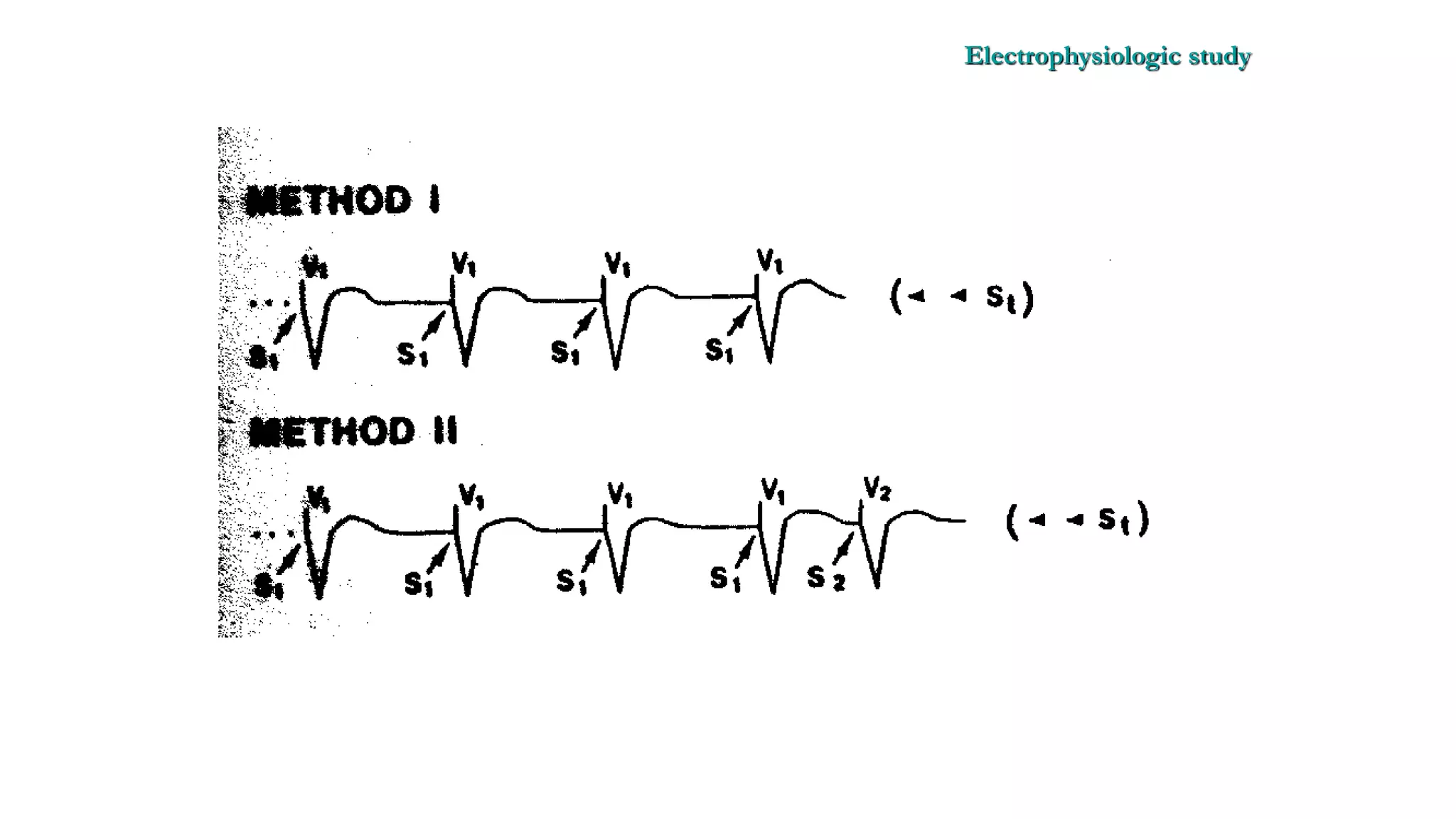 Basics of Electrophysiologic study, part 1 (2020)