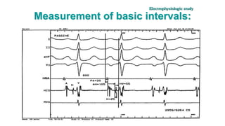 Basics of Electrophysiologic study, part 1 (2020) | PPTX