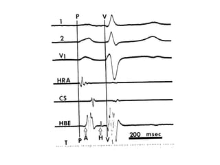 Electrophysiology basics,part1(lecture) | PPT