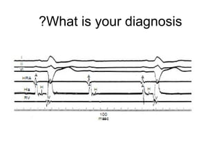 What is your diagnosis?
 
