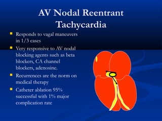 AV Nodal Reentrant
Tachycardia
 Responds to vagal maneuvers
in 1/3 cases
 Very responsive to AV nodal
blocking agents such as beta
blockers, CA channel
blockers, adenosine.
 Recurrences are the norm on
medical therapy
 Catheter ablation 95%
successful with 1% major
complication rate
 