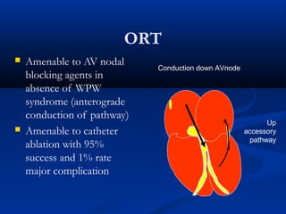 ORT
 Amenable to AV nodal
blocking agents in
absence of WPW
syndrome (anterograde
conduction of pathway)
 Amenable to catheter
ablation with 95%
success and 1% rate
major complication
Conduction down AVnode
Up
accessory
pathway
 