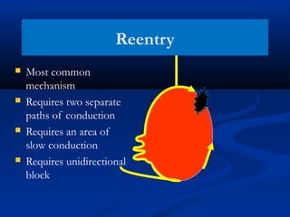 Reentry
 Most common
mechanism
 Requires two separate
paths of conduction
 Requires an area of
slow conduction
 Requires unidirectional
block
 