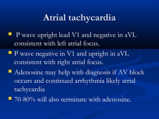 Atrial tachycardia
 P wave upright lead V1 and negative in aVL
consistent with left atrial focus.
 P wave negative in V1 and upright in aVL
consistent with right atrial focus.
 Adenosine may help with diagnosis if AV block
occurs and continued arrhythmia likely atrial
tachycardia
 70-80% will also terminate with adenosine.
 