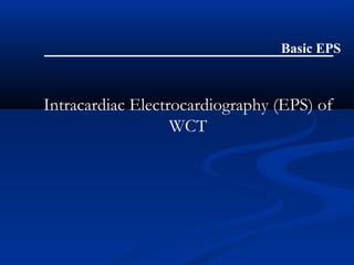 Intracardiac Electrocardiography (EPS) of
WCT
Basic EPS
 