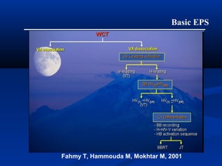 Basic EPS
Fahmy T, Hammouda M, Mokhtar M, 2001
 