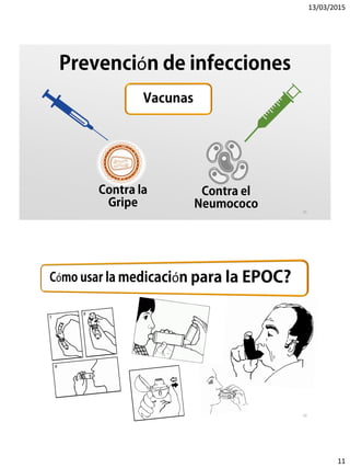 13/03/2015
11
ó
21
22
 