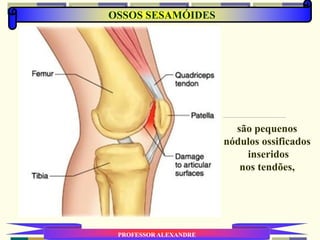 OSSOS SESAMÓIDES
PROFESSOR ALEXANDRE
são pequenos
nódulos ossificados
inseridos
nos tendões,
 
