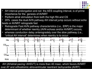 Comprehensive Electrophysiological Study in Supraventricular ...