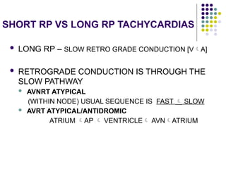 Comprehensive Electrophysiological Study in Supraventricular ...