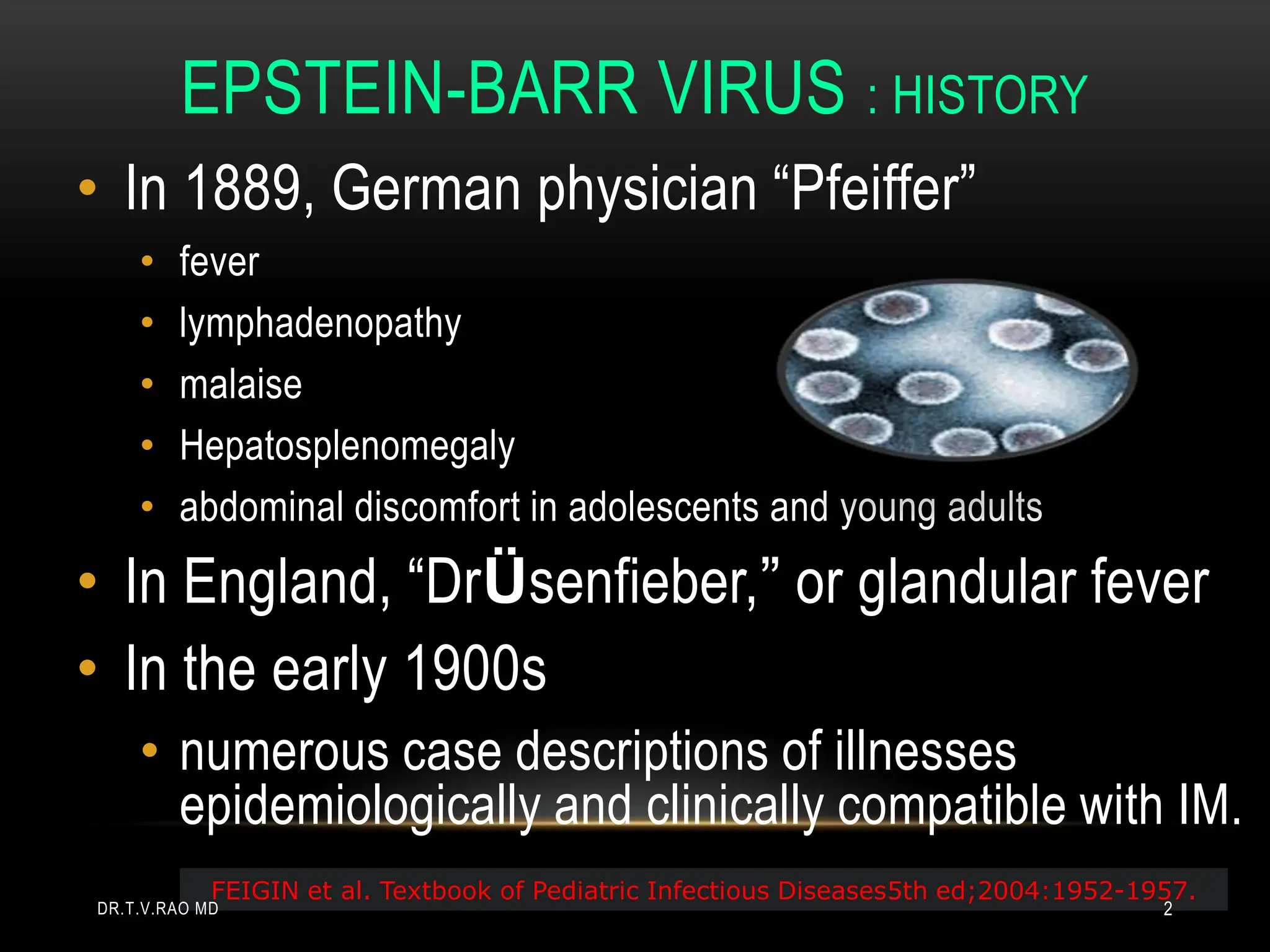EPSTEIN-BARR VIRUS : HISTORY
• In 1889, German physician “Pfeiffer”
• fever
• lymphadenopathy
• malaise
• Hepatosplenomegaly
• abdominal discomfort in adolescents and young adults
• In England, “DrÜsenfieber,” or glandular fever
• In the early 1900s
• numerous case descriptions of illnesses
epidemiologically and clinically compatible with IM.
FEIGIN et al. Textbook of Pediatric Infectious Diseases5th ed;2004:1952-1957.
DR.T.V.RAO MD 2