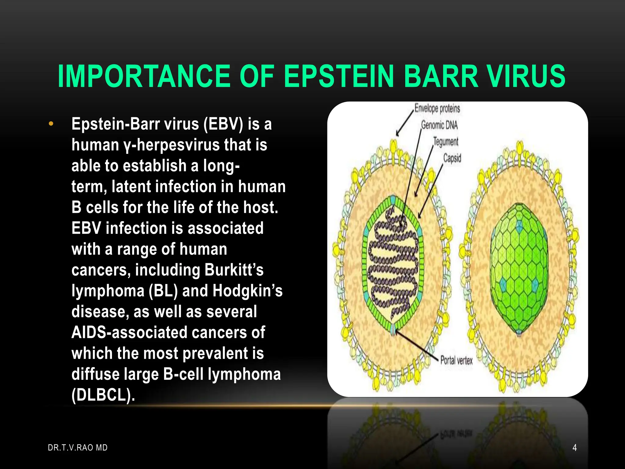• Epstein-Barr virus (EBV) is a
human γ-herpesvirus that is
able to establish a long-
term, latent infection in human
B cells for the life of the host.
EBV infection is associated
with a range of human
cancers, including Burkitt’s
lymphoma (BL) and Hodgkin’s
disease, as well as several
AIDS-associated cancers of
which the most prevalent is
diffuse large B-cell lymphoma
(DLBCL).
IMPORTANCE OF EPSTEIN BARR VIRUS
DR.T.V.RAO MD 4