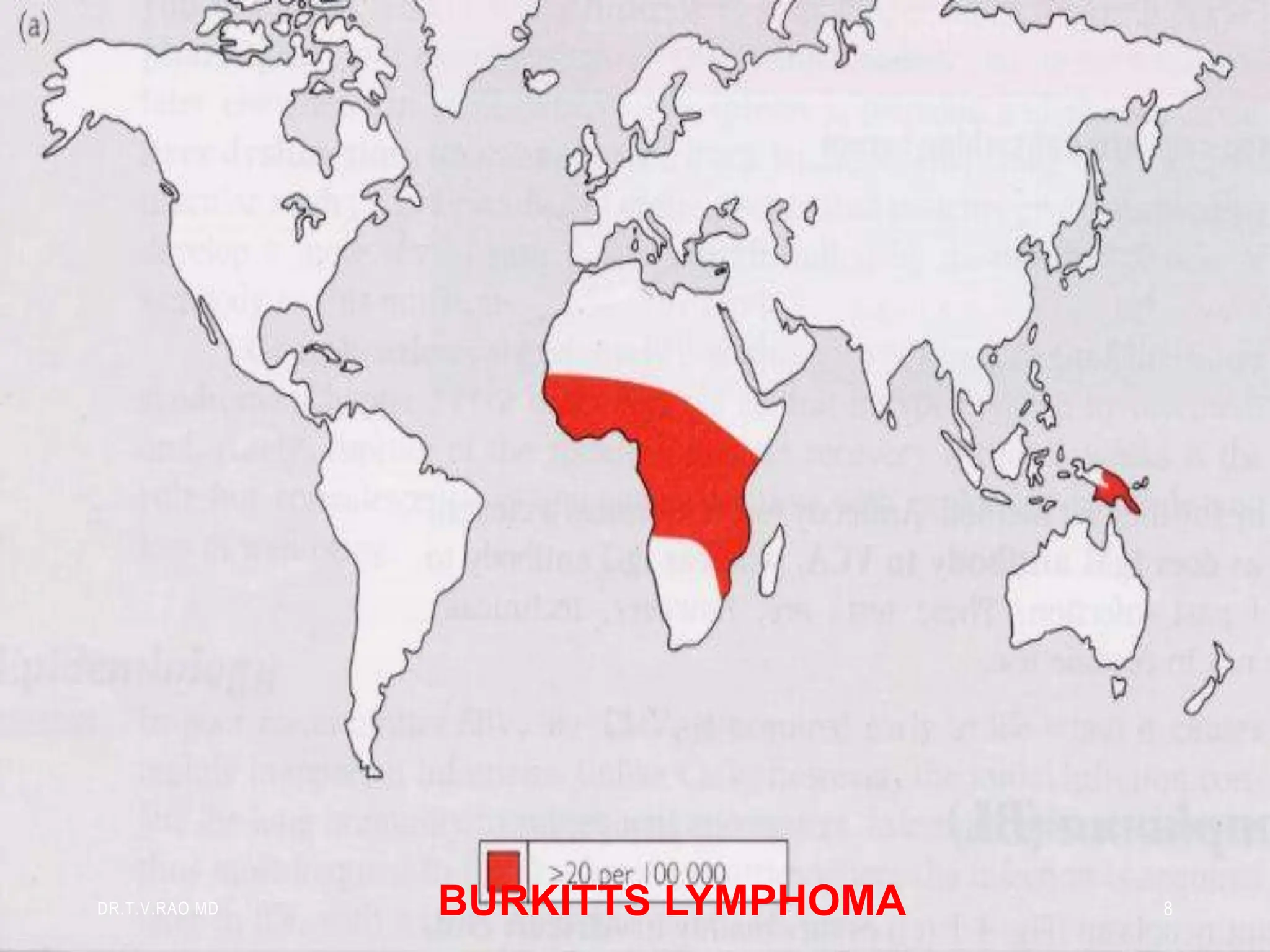 BURKITTS LYMPHOMA
DR.T.V.RAO MD 8