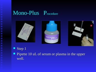 Epstein_Barr_Virius.ppt.pdf