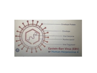 EPSTEIN BARR VIRUS (herpesviridae) .pptx