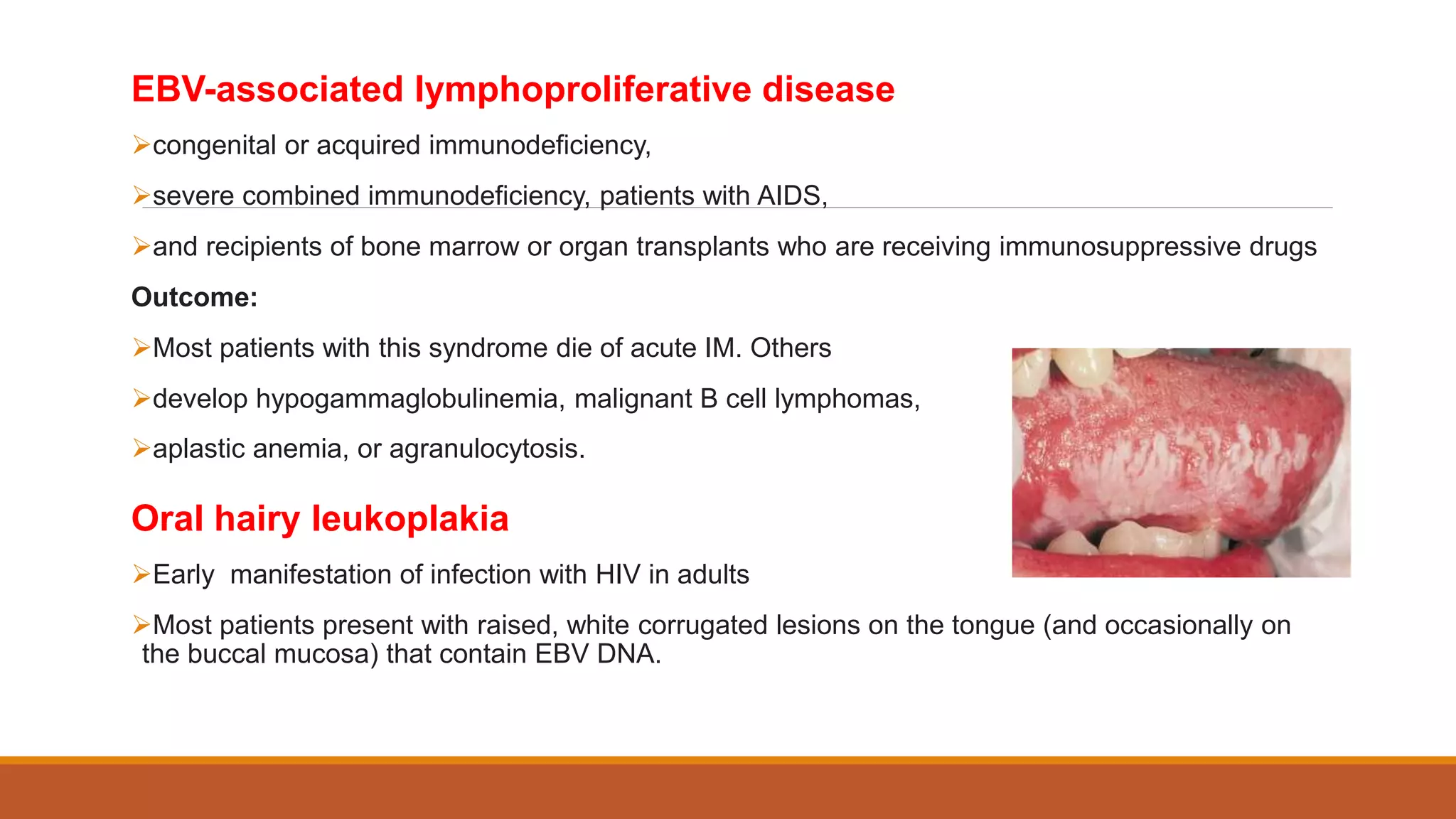 EBV-associated lymphoproliferative disease
congenital or acquired immunodeficiency,
severe combined immunodeficiency, patients with AIDS,
and recipients of bone marrow or organ transplants who are receiving immunosuppressive drugs
Outcome:
Most patients with this syndrome die of acute IM. Others
develop hypogammaglobulinemia, malignant B cell lymphomas,
aplastic anemia, or agranulocytosis.
Oral hairy leukoplakia
Early manifestation of infection with HIV in adults
Most patients present with raised, white corrugated lesions on the tongue (and occasionally on
the buccal mucosa) that contain EBV DNA.
 