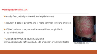 Maculopapular rash : 15%
usually faint, widely scattered, and erythematous
occurs in 3-15% of patients and is more common in young children.
80% of patients, treatment with amoxicillin or ampicillin is
associated with rash
Circulating immunoglobulin G (IgG) and
immunoglobulin M (IgM) antibodies to ampicillin are demonstrable NEJM;343:481-492.
 
