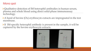 Mono spot
Qualitative detection of IM heterophil antibodies in human serum,
plasma and whole blood using direct solid-phase immunoassay
technology.
A band of bovine (Ox) erythrocyte extracts are impregnated in the test
membrane.
If IM-specific heterophil antibody is present in the sample, it will be
captured by the bovine erythrocyte extracts.
 