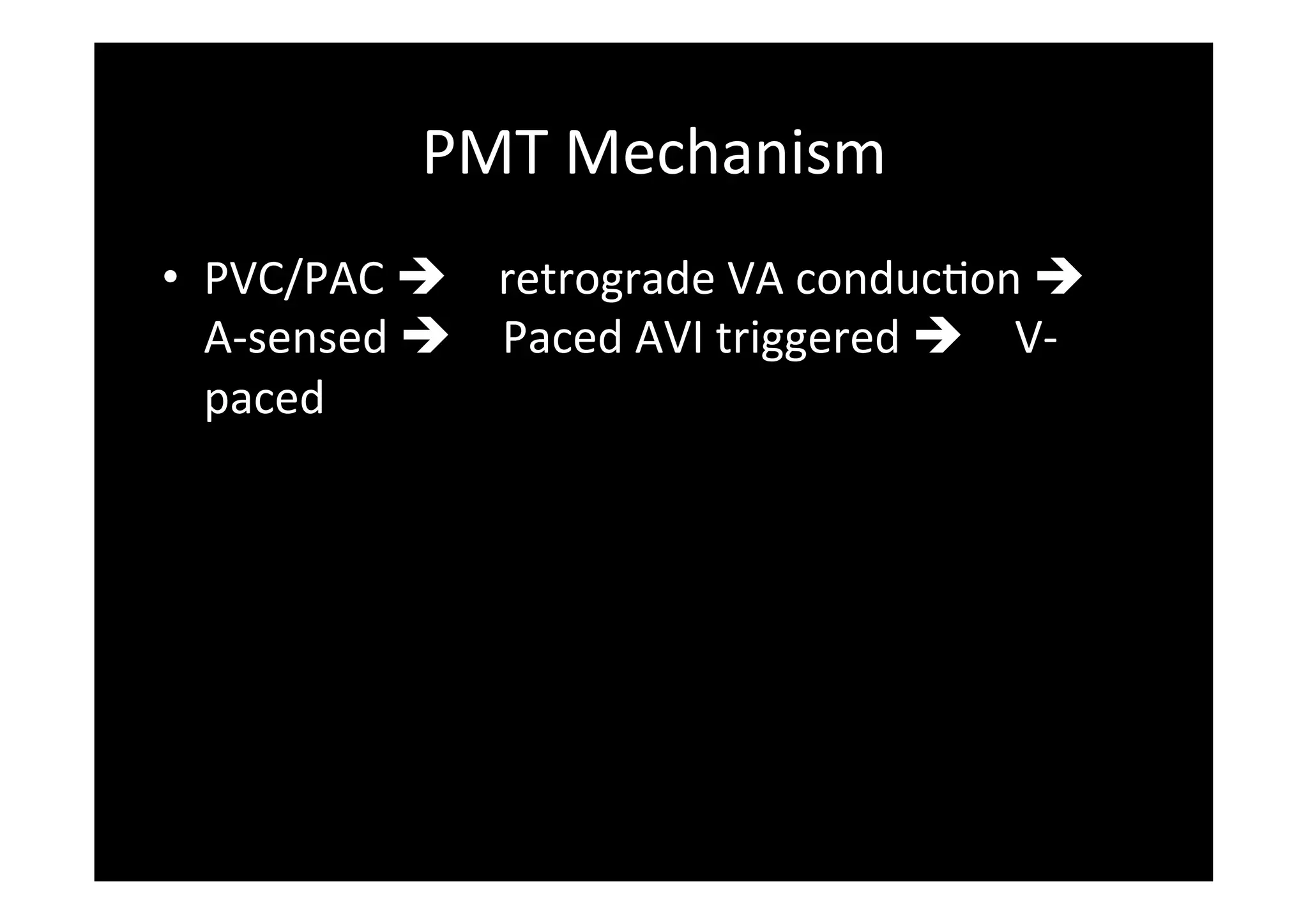 PMT	
  Mechanism	
  
•  PVC/PAC	
  è retrograde	
  VA	
  conducPon	
  è
A-­‐sensed	
  è Paced	
  AVI	
  triggered	
  è V-­‐
paced	
  
 