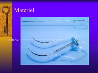 Materiel Prothèse 