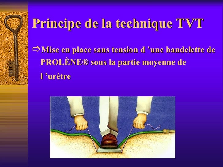 Epu Traitement de l'incontinence urinaire de la femme