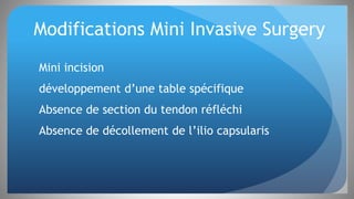 Modifications Mini Invasive Surgery
Mini incision
développement d’une table spécifique
Absence de section du tendon réfléchi
Absence de décollement de l’ilio capsularis
 