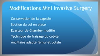 Modifications Mini Invasive Surgery
Conservation de la capsule
Section du col en place
Ecarteur de Charnley modifié
Technique de fraisage du cotyle
Ancillaire adapté fémur et cotyle
 