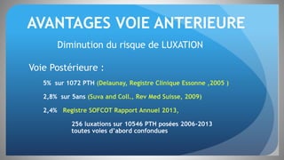 AVANTAGES VOIE ANTERIEURE
Diminution du risque de LUXATION
Voie Postérieure :
5% sur 1072 PTH (Delaunay, Registre Clinique Essonne ,2005 )
2,8% sur 5ans (Suva and Coll., Rev Med Suisse, 2009)
2,4% Registre SOFCOT Rapport Annuel 2013,
256 luxations sur 10546 PTH posées 2006-2013
toutes voies d’abord confondues
 