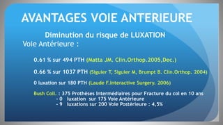 AVANTAGES VOIE ANTERIEURE
Diminution du risque de LUXATION
Voie Antérieure :
0.61 % sur 494 PTH (Matta JM. Clin.Orthop.2005,Dec.)
0.66 % sur 1037 PTH (Siguier T, Siguier M, Brumpt B. Clin.Orthop. 2004)
0 luxation sur 180 PTH (Laude F.Interactive Surgery. 2006)
Bush Coll. : 375 Prothèses Intermédiaires pour Fracture du col en 10 ans
- 0 luxation sur 175 Voie Antérieure
- 9 luxations sur 200 Voie Postérieure : 4,5%
 