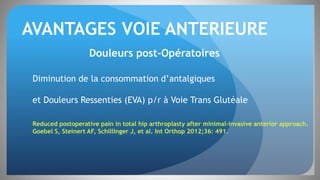 AVANTAGES VOIE ANTERIEURE
Douleurs post-Opératoires
Diminution de la consommation d’antalgiques
et Douleurs Ressenties (EVA) p/r à Voie Trans Glutéale
Reduced postoperative pain in total hip arthroplasty after minimal-invasive anterior approach.
Goebel S, Steinert AF, Schillinger J, et al. Int Orthop 2012;36: 491.
 