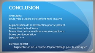 CONCLUSION
Avantages:
Seule Voie d’Abord Strictement Mini-Invasive
Augmentation de la satisfaction pour le patient
Diminution de la douleur
Diminution du traumatisme musculo-tendineux
Durée de récupération
Luxation +++
Elément négatif :
Augmentation de la courbe d’apprentissage pour le chirurgien
 