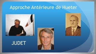 JUDET
Approche Antérieure de Hueter
 