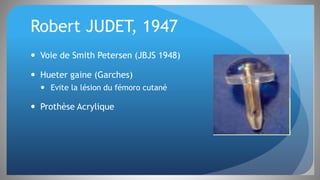 Robert JUDET, 1947
 Voie de Smith Petersen (JBJS 1948)
 Hueter gaine (Garches)
 Evite la lésion du fémoro cutané
 Prothèse Acrylique
 