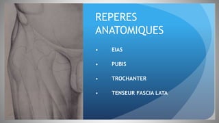 REPERES
ANATOMIQUES
• EIAS
• PUBIS
• TROCHANTER
• TENSEUR FASCIA LATA
 