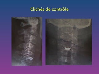 Clichés de contrôle 