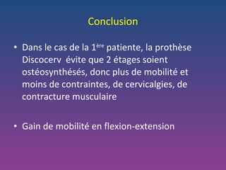 Conclusion Dans le cas de la 1 ère  patiente, la prothèse Discocerv  évite que 2 étages soient ostéosynthésés, donc plus de mobilité et moins de contraintes, de cervicalgies, de contracture musculaire Gain de mobilité en flexion-extension 