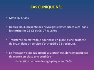 Mme  B, 47 ans Depuis 2003, présente des névralgies cervico-brachiales  dans les territoires C5-C6 et C6-C7 gauches . Transférée en métropole pour mise en place d’une prothèse de Bryan dans un service d’orthopédie à Strasbourg. Le fraisage n’était pas adapté à la prothèse, donc impossibilité de mettre en place une prothèse ->  décision de pose de cage-plaque en C5-C6 CAS CLINIQUE N°1 