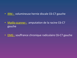 IRM :  volumineuse hernie discale C6-C7 gauche Myélo-scanner :   amputation de la racine C6-C7 gauche EMG :   souffrance chronique radiculaire C6-C7 gauche 