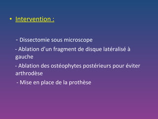 Intervention : -  Dissectomie sous microscope - Ablation d’un fragment de disque latéralisé à gauche - Ablation des ostéophytes postérieurs pour éviter arthrodèse - Mise en place de la prothèse 