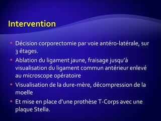 Décision corporectomie par voie antéro-latérale, sur 3 étages. Ablation du ligament jaune, fraisage jusqu’à visualisation du ligament commun antérieur enlevé au microscope opératoire Visualisation de la dure-mère, décompression de la moelle Et mise en place d’une prothèse T-Corps avec une plaque Stella. 