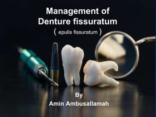 Management of Denture fissuratum( epulisfissuratum) By Amin Ambusallamah 