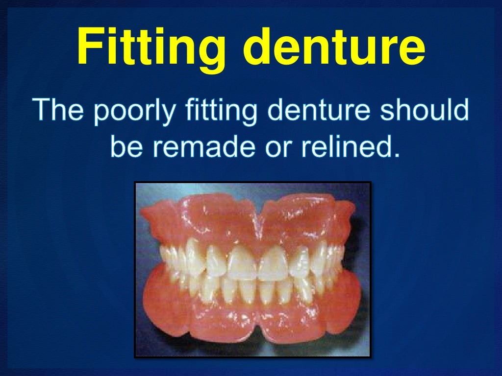 Management of Epulis fissuratum