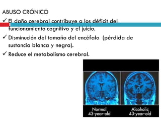 ABUSO CRÓNICO
 El daño cerebral contribuye a los déficit del
funcionamiento cognitivo y el juicio.
 Disminución del tamaño del encéfalo (pérdida de
sustancia blanca y negra).
 Reduce el metabolismo cerebral.

 