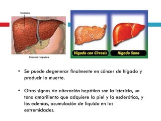 • Se puede degenerar finalmente en cáncer de hígado y
producir la muerte.

• Otros signos de alteración hepática son la ictericia, un
tono amarillento que adquiere la piel y la esclerótica, y
los edemas, acumulación de líquido en las
extremidades.

 