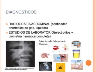 DIAGNOSTICOS
 RADIOGRAFIA ABDOMINAL (cantidades
anormales de gas, liquidos)
 ESTUDIOS DE LABORATORIO(electrolitos y
biometria hematica completa)
 