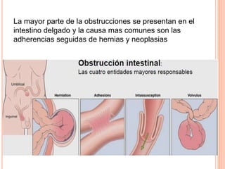 La mayor parte de la obstrucciones se presentan en el
intestino delgado y la causa mas comunes son las
adherencias seguidas de hernias y neoplasias
 