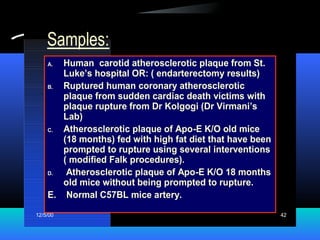 12/5/00 42
Samples:
A. Human carotid atherosclerotic plaque from St.
Luke’s hospital OR: ( endarterectomy results)
B. Ruptured human coronary atherosclerotic
plaque from sudden cardiac death victims with
plaque rupture from Dr Kolgogi (Dr Virmani’s
Lab)
C. Atherosclerotic plaque of Apo-E K/O old mice
(18 months) fed with high fat diet that have been
prompted to rupture using several interventions
( modified Falk procedures).
D. Atherosclerotic plaque of Apo-E K/O 18 months
old mice without being prompted to rupture.
E. Normal C57BL mice artery.
 