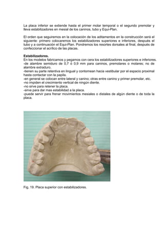 La placa inferior se extiende hasta el primer molar temporal o el segundo premolar y 
lleva estabilizadores en mesial de l...