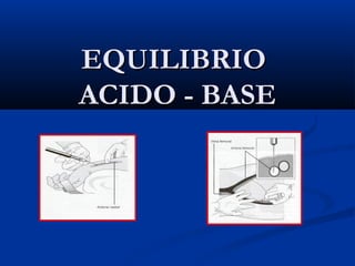 EQUILIBRIOEQUILIBRIO
ACIDO - BASEACIDO - BASE
 