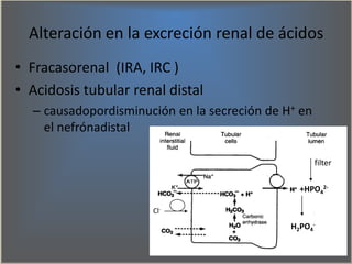 +HPO4
2-
H2PO4
-
filter
Alteración en la excreción renal de ácidos
• Fracasorenal (IRA, IRC )
• Acidosis tubular renal dis...